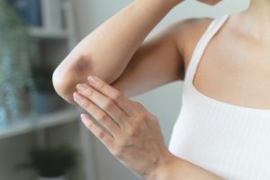 Como tirar roxo da pele: dicas e tratamentos eficientes
