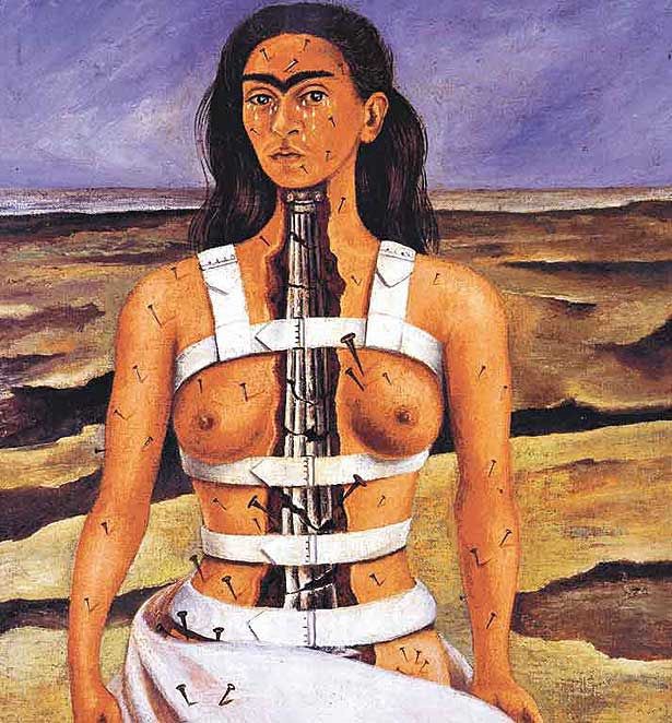  Frida Kahlo: coluna partida